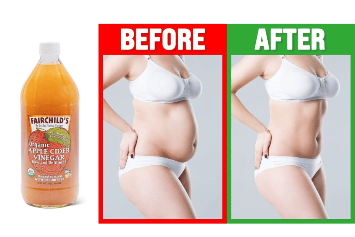 Drinking Apple Cider Vinegar to Lose Weight