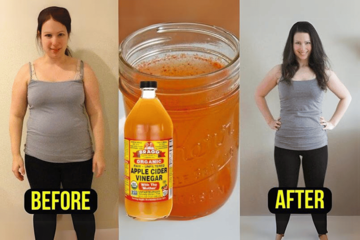 Drinking Apple Cider Vinegar to Lose Weight